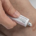 Antifungal Infection Cream: What Doctors Want You to Know