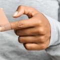 Skin Avulsion Wound on Finger: Symptoms, Treatments & Recovery Timeline