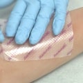 Nighttime Recovery Hacks: How to Heal Cuts Faster Overnight