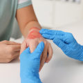 Expert Tips Revealed: Healthy vs Infected Wound Prevention & Care