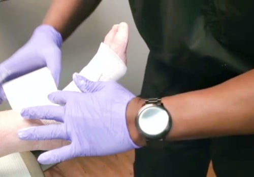 Unna Boot Application: Discover How to Reduce Swelling and Boost Healing