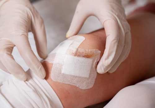 Complete Guide to Serosanguineous Drainage: What to Know and Do