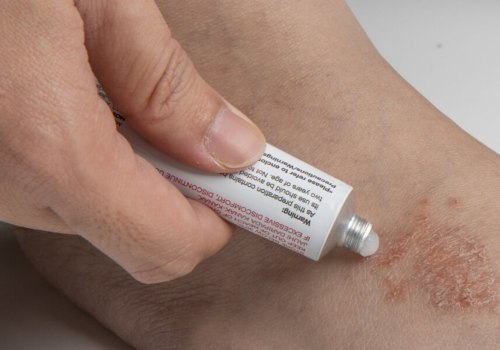 Antifungal Infection Cream: What Doctors Want You to Know